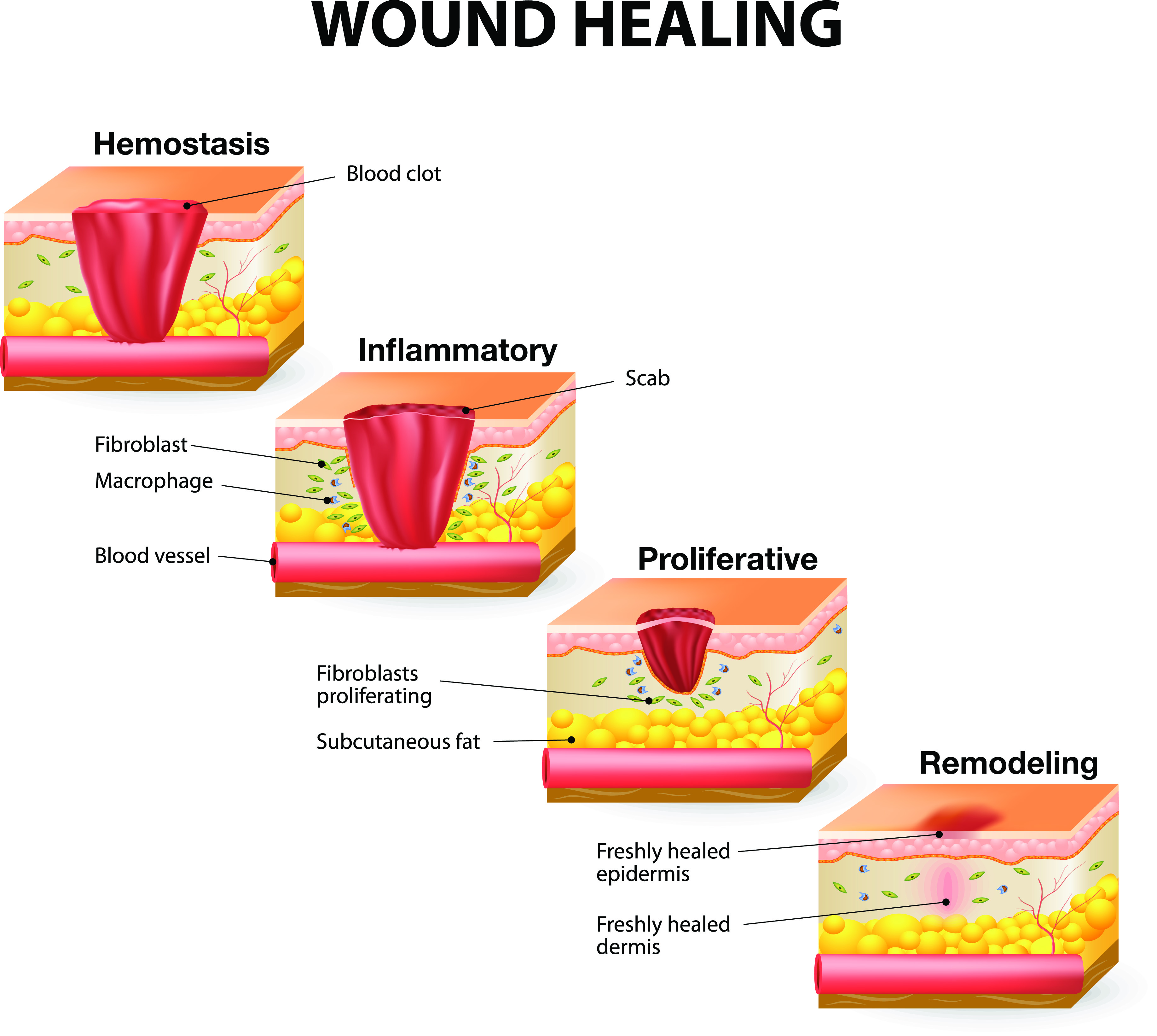 How Wounds Heal: The 4 Main Phases of Wound Healing | Shield HealthCare