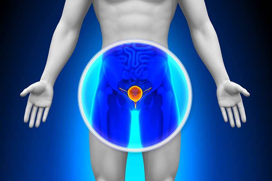 Kidney Pain or Renal Colic - Causes and Treatment - Best Urologist in  Manhattan - Treatment of Urological Pain Syndromes