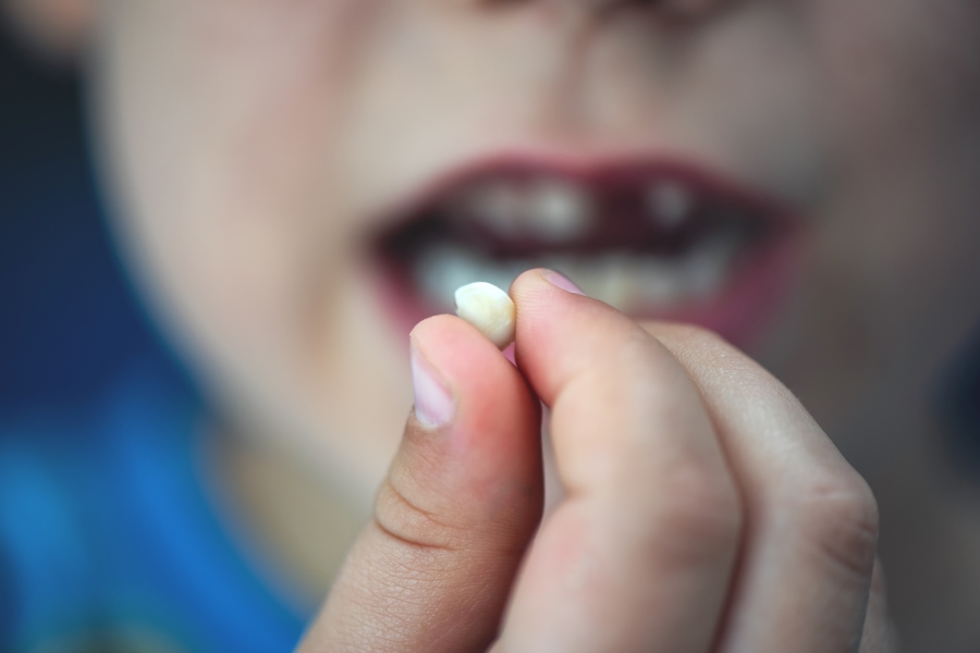 First Lost Tooth